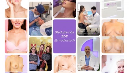Sledujte nás nyní! Exkluzivní nabídky na našem Instagramu. | Klinika Mediestetik