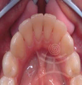 Dentální hygiena | Klinika Mediestetik