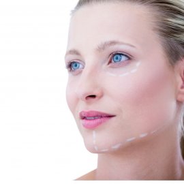 Facelift a necklift | Klinika Mediestetik