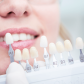 Zubní fazety | Klinika Mediestetik