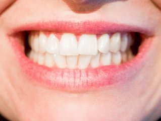 Konec praskajících zubních náhrad | Klinika Mediestetik