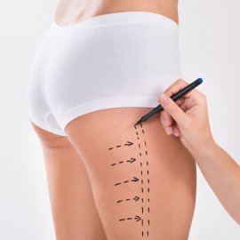 Mommy Makeover – solution for mothers after childbirth | Klinika Mediestetik
