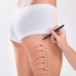 Mommy Makeover – Lösung für Mütter nach der Geburt | Klinika Mediestetik