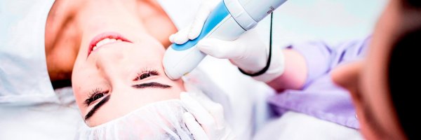 Laserpeeling und Verjüngung von Gesicht Palomar