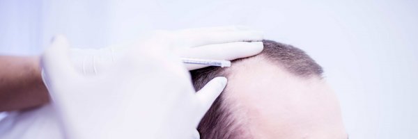 Micrografting: Obnova růstu vlasů a intenzivní biorevitalizace pokožky | Klinika Mediestetik