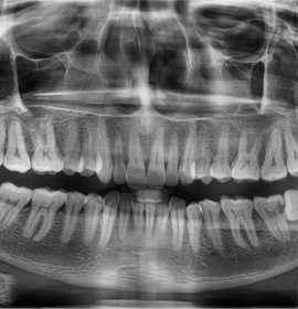 Radiodiagnostics in Dentistry | Klinika Mediestetik