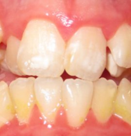 Orthodontists and orthodontic treatment | Klinika Mediestetik