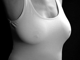 Kdy může být plastika prsou takřka zadarmo? | Klinika Mediestetik