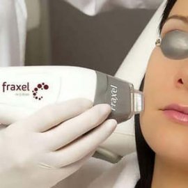 Verjüngung von der Haut im Gesicht mit dem Fraktionslaser Fraxel | Klinika Mediestetik