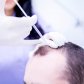 RegenPlasma: Get Rid of Hair Loss on a Cellular Level | Klinika Mediestetik