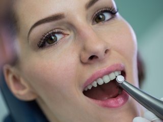 Co způsobuje zubní kaz? | Klinika Mediestetik